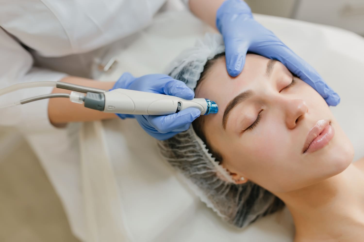 Dermapen (Microneedling)