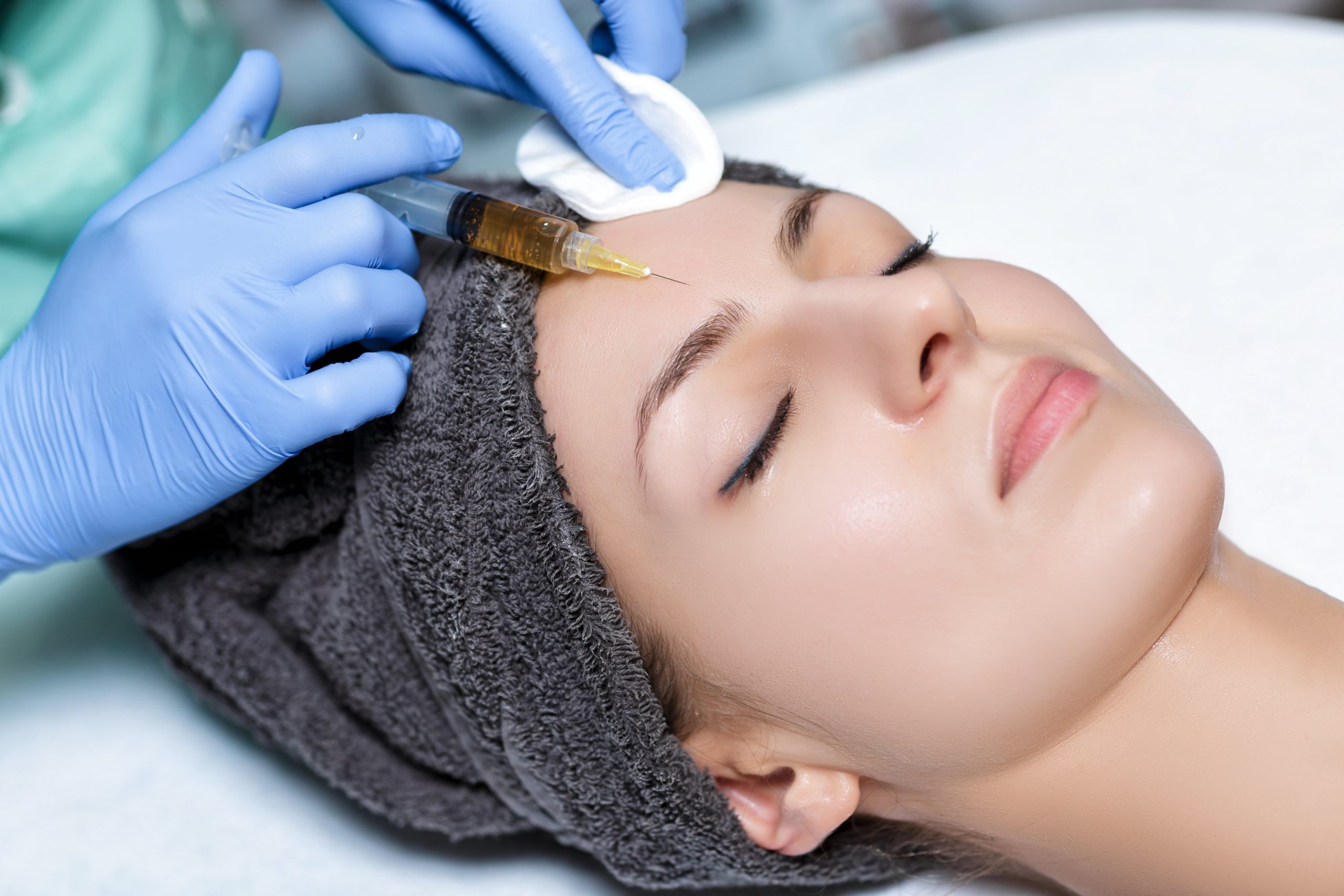 Plasma Rico en Plaquetas (PRP) y Filler con Plasma