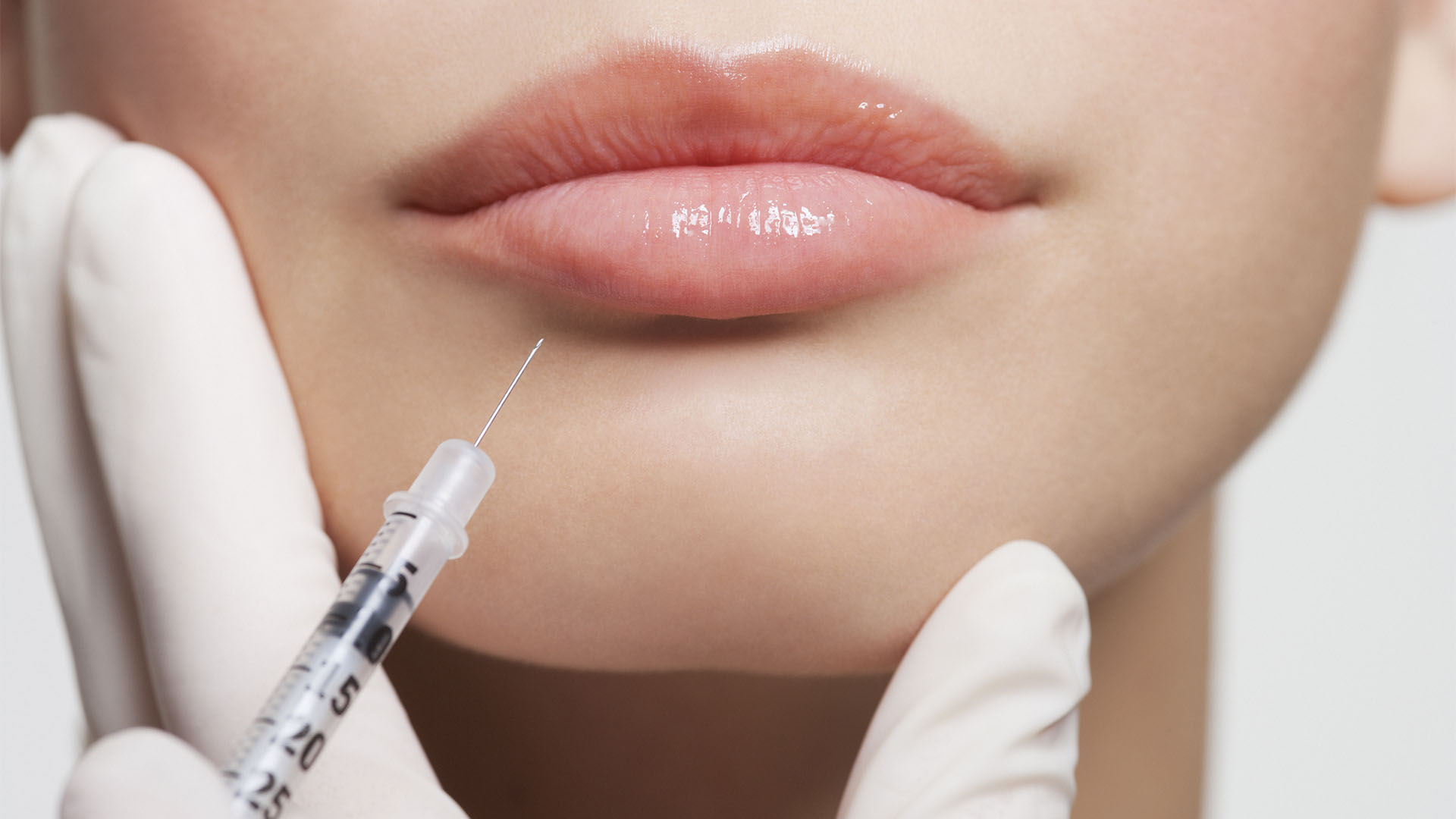 Relleno de Labios
