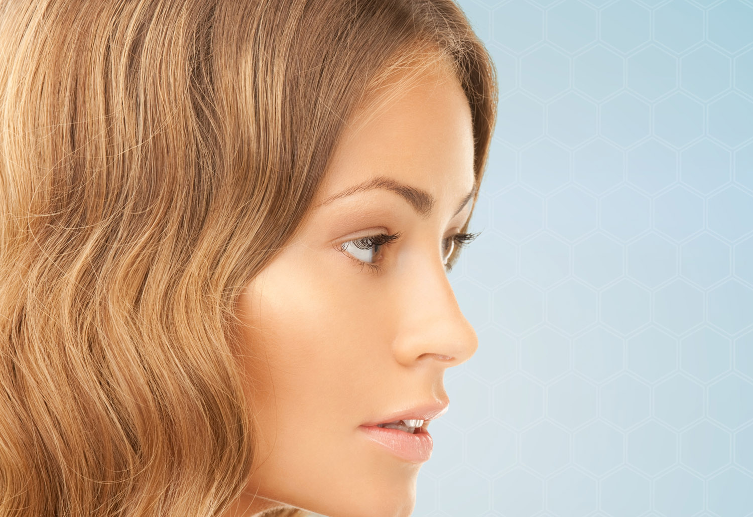 Rinoplastia realizada por la Dra. Marta Leguizamon